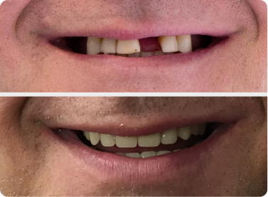 Before and after