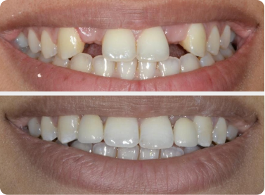 Before and after